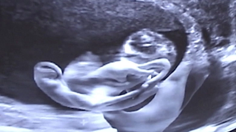 Castration Movie Anthology Iii. Year Of The Hyaena (2026)