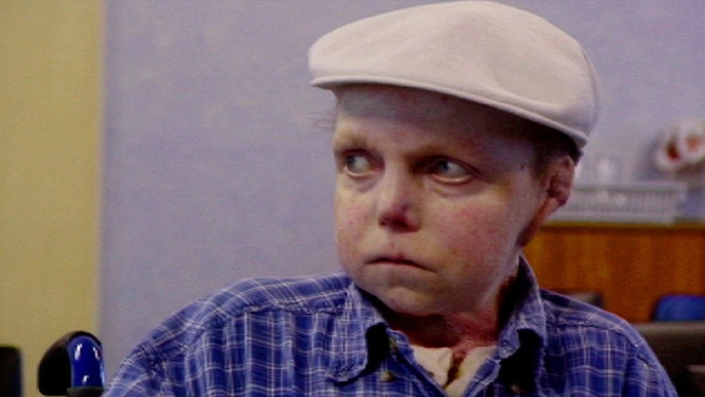 The Boy Whose Skin Fell Off (2004)