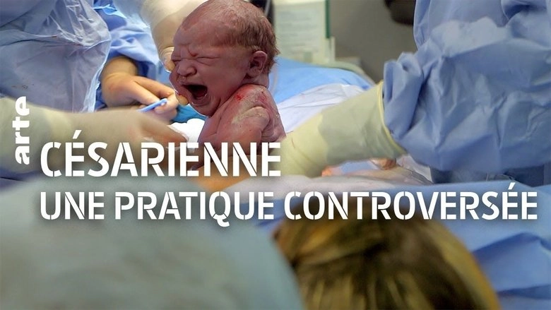 C-Section Controversy (2016)