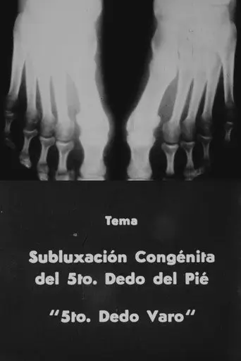 5to. dedo varo (1959)