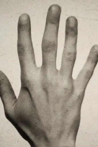 Fifth Metacarpal (2018)